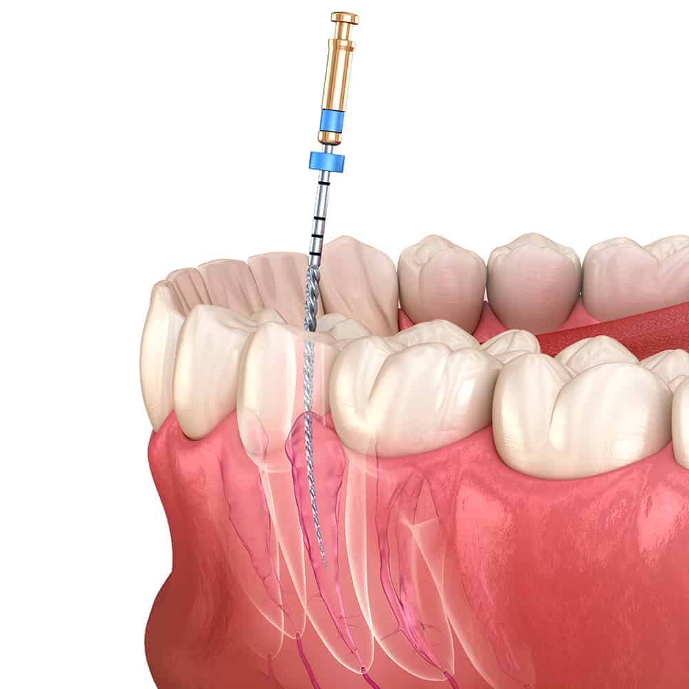Especialidades | Dentisteria