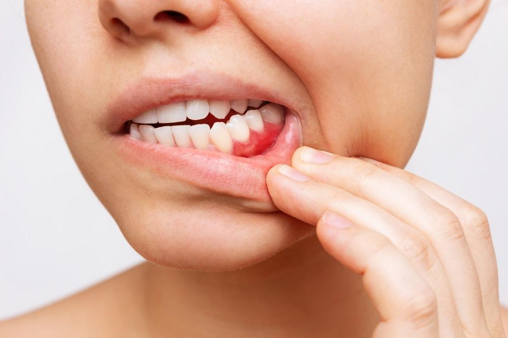 Especialidades | Periodontologia