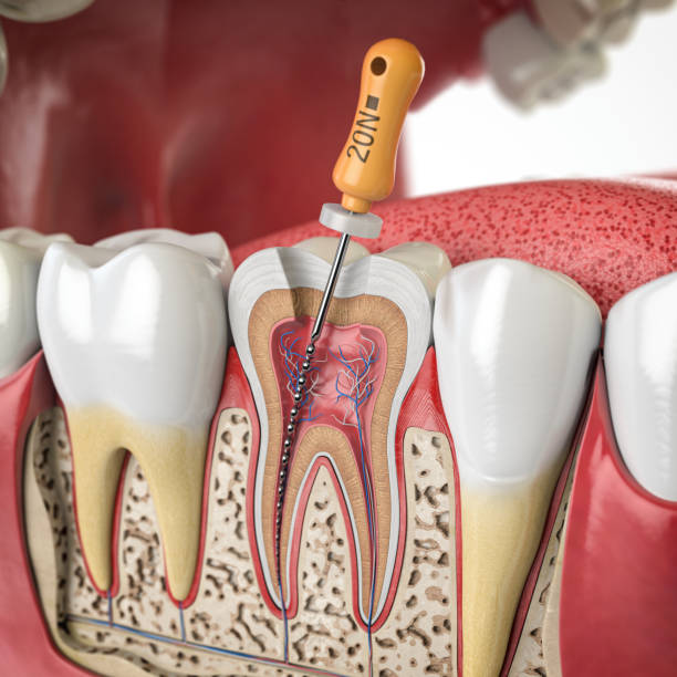 Especialidades | Endodontia